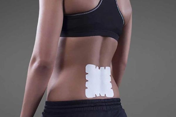 Lidocaine Patches for fibromyalgia